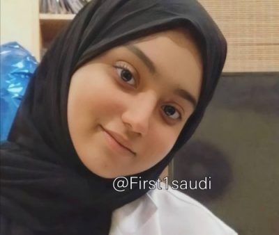 عظام صناعية من كربونات كالسيوم الصدف كبديل للأسياخ عظام صناعية من كربونات كالسيوم الصدف كبديل للأسياخ